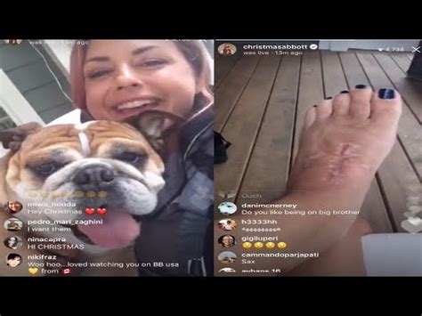 BB19 CHRISTMAS ABBOTT GIVES FOOT UPDATES